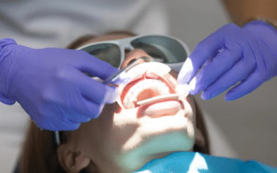 Reasons Why You Should Consider LANAP for Your Dental Procedure