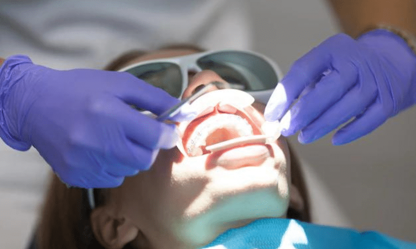 Reasons Why You Should Consider LANAP for Your Dental Procedure (1)