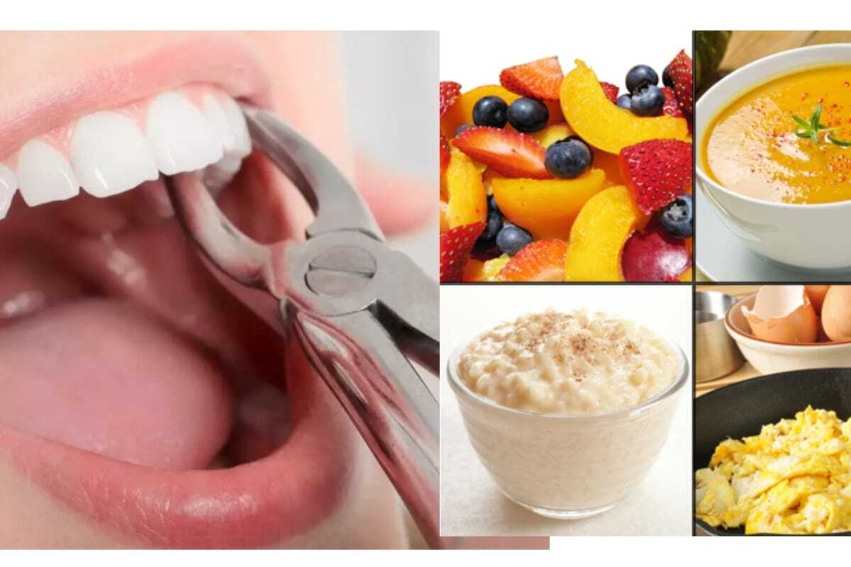 Soft foods to eat after a tooth extraction for faster healing and comfort