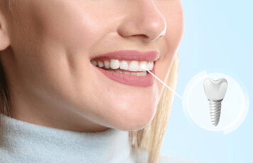 dental implant recovery time
