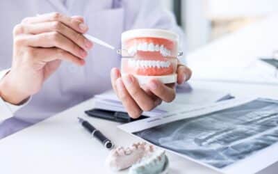 What to Expect After a Bone Grafting Procedure