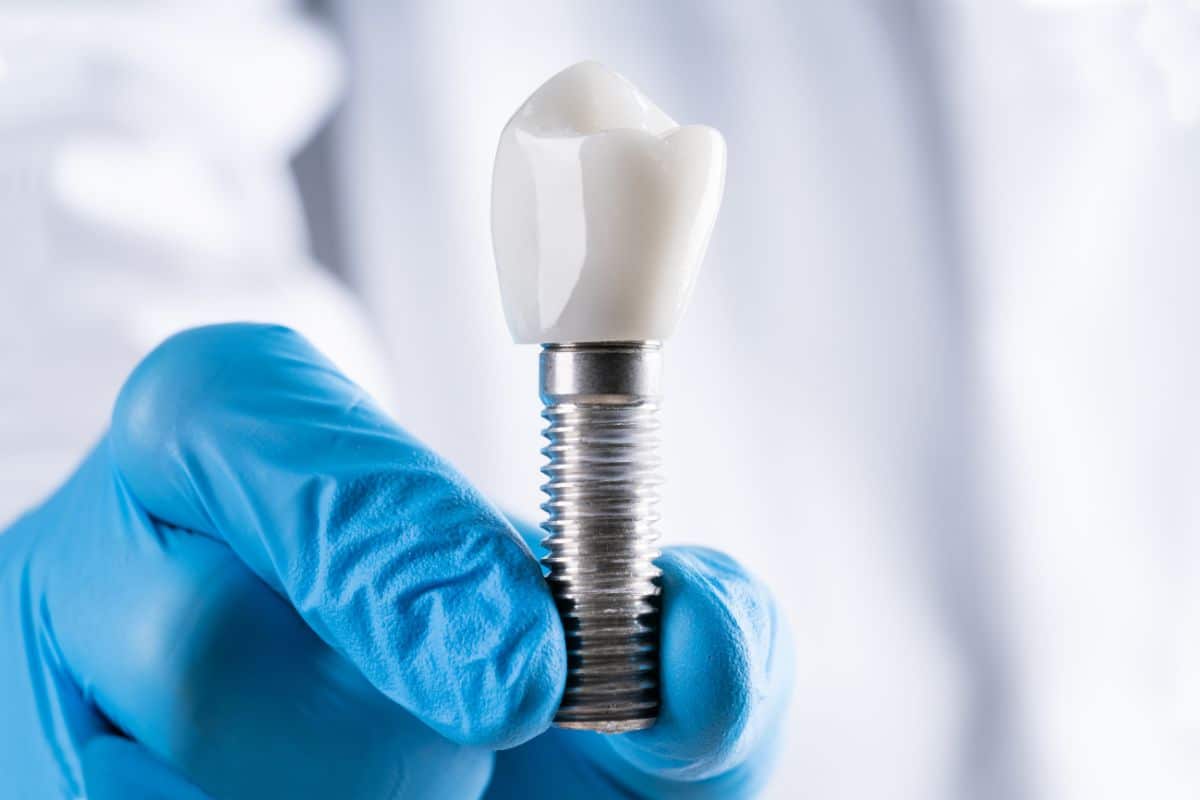 Why Tooth Replacement With Dental Implants Is A Popular Option