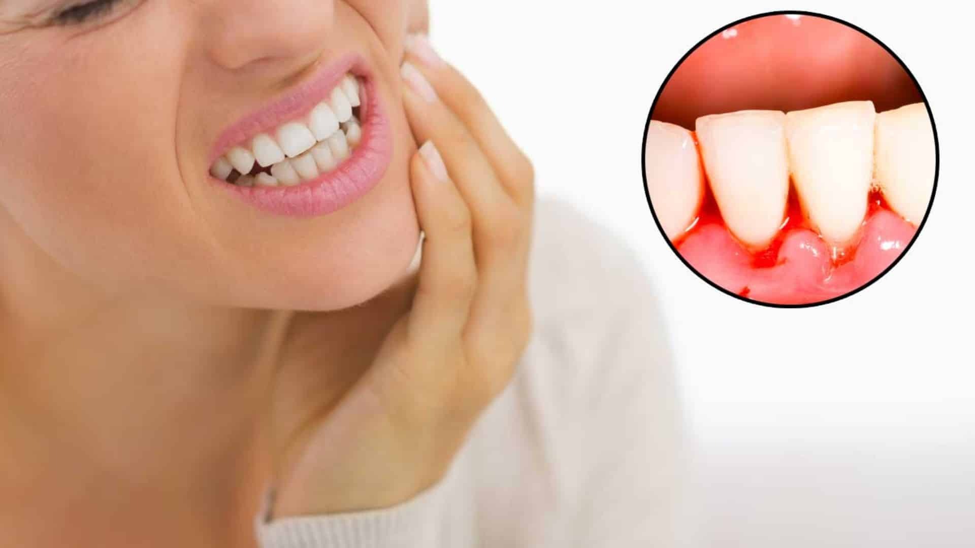 Treat Periodontal Disease