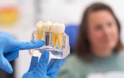 10 Ways to Acquire Affordable Dental Implants Immediately and Safely