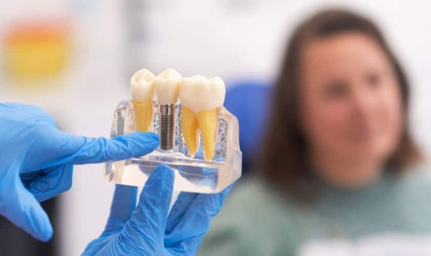 Affordable Dental Implants