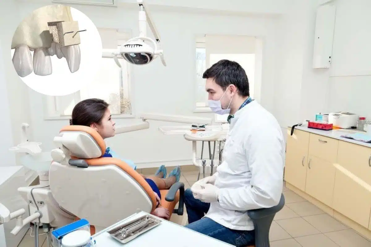 Why Need Ridge Augmentation