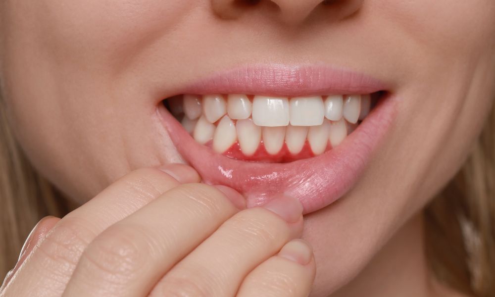 Tips to Keep Your Gums Healthy