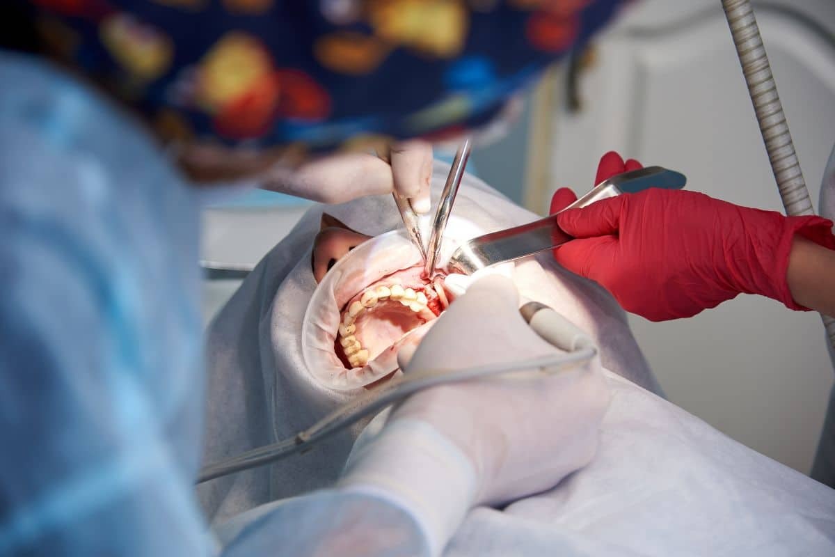 How Effective is Osseous Surgery for Treating Gum Disease