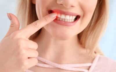 What Is Gingival Graft Treatment? Understanding the Procedure and Its Benefits