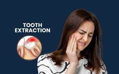 Tooth Extraction: Cost, Procedure, Risks & Recovery
