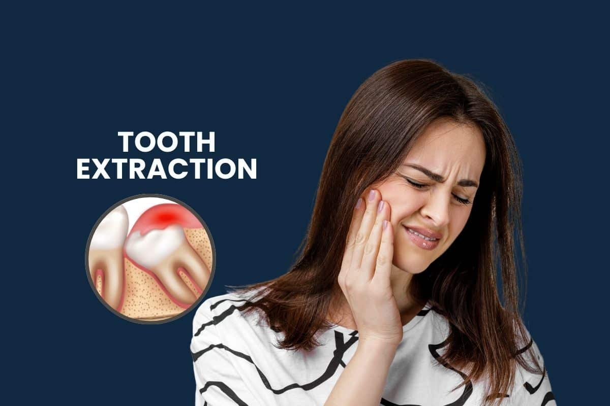 Tooth Extraction: Cost, Procedure, Risks & Recovery