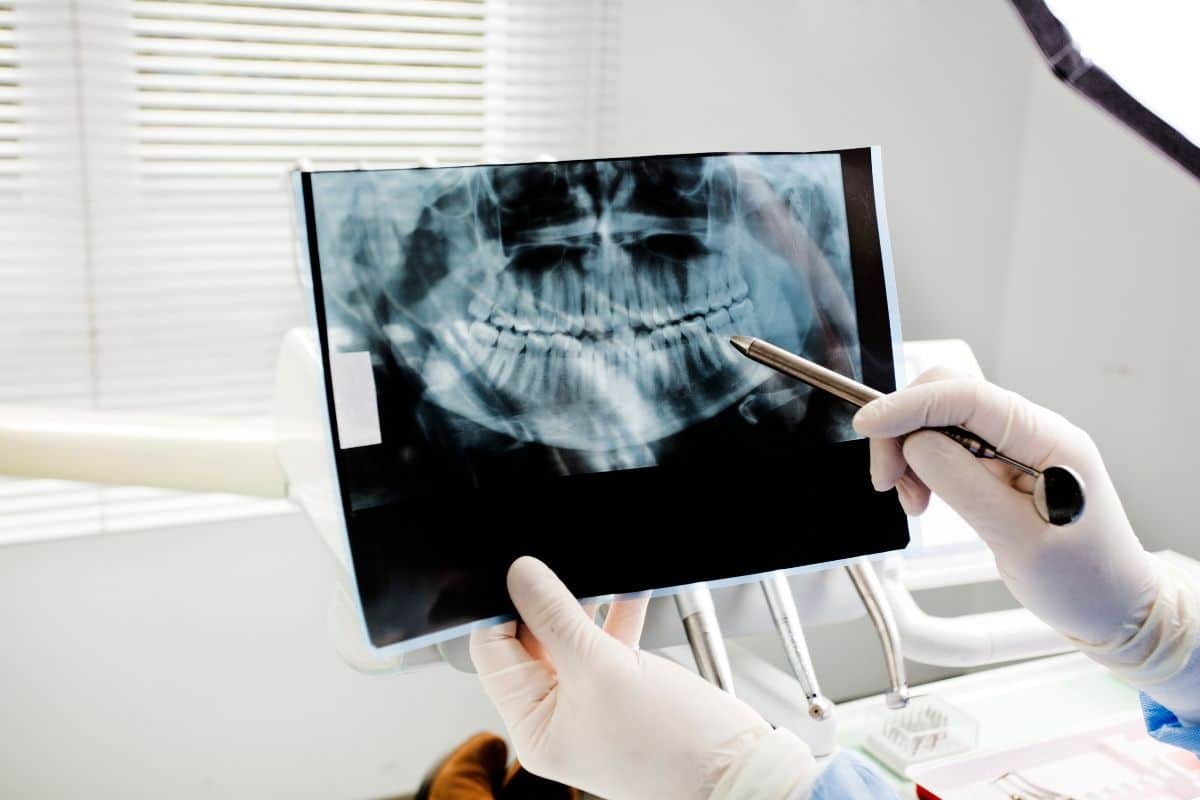 Safety of Dental X-Rays and CT Scans