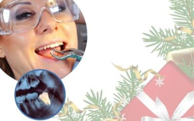 Care for Your Teeth After a Tooth Extraction Over Christmas