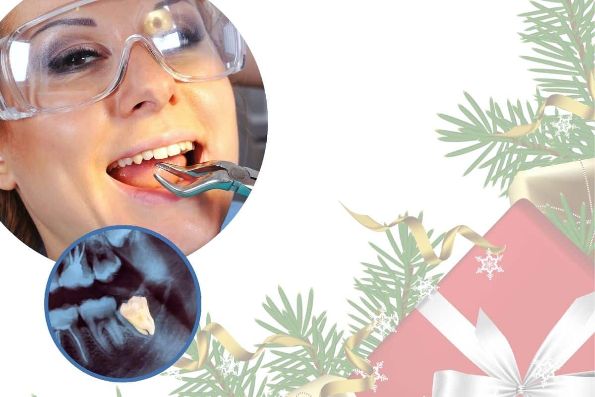 Care for Your Teeth After a Tooth Extraction Over Christmas