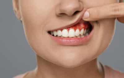 How Can I Treat Periodontal Disease in My Teeth?
