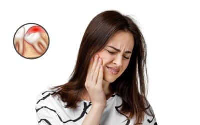 How Much Time Does It Take for a Tooth Extraction to Heal?