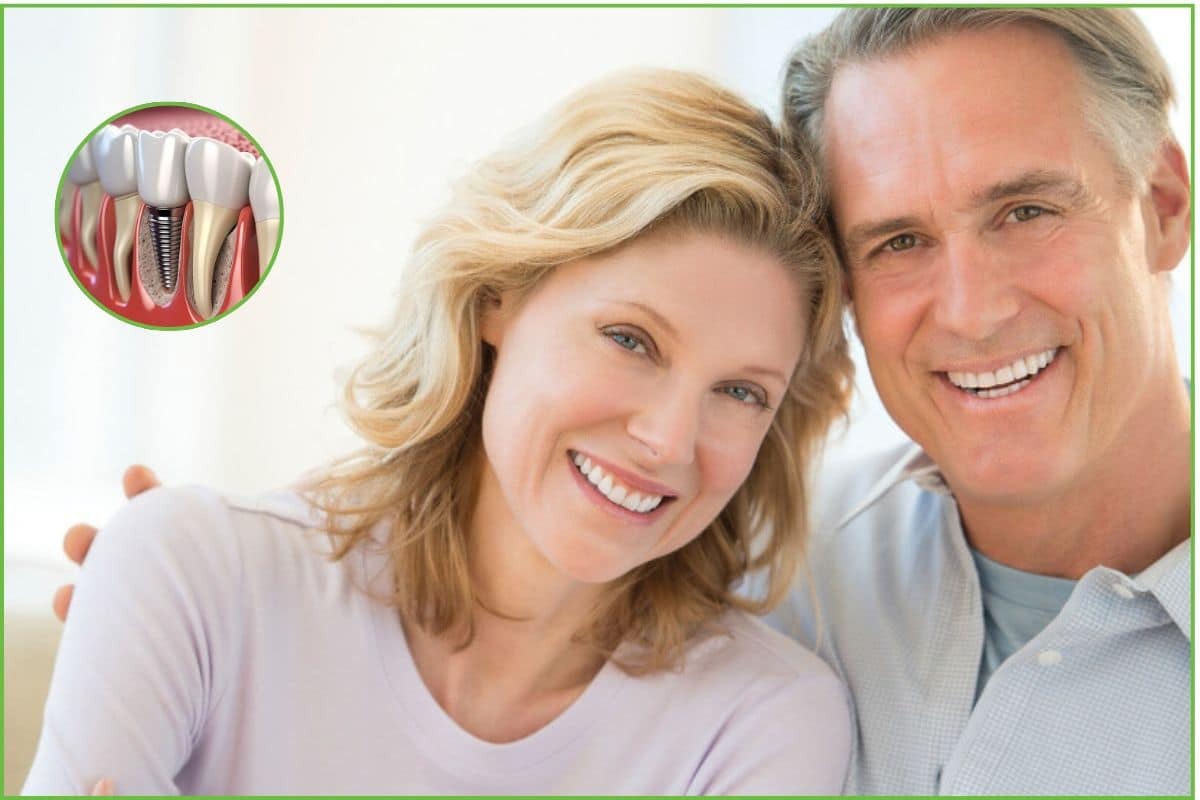 Dental Implant Care: How to Look After Your Implants