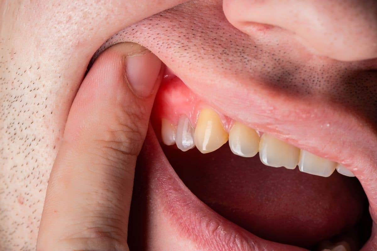 How Gum Disease Affects More Than Just Your Mouth How Gum Disease Affects More Than Just Your Mouth