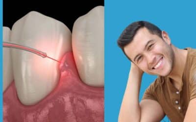 How Effective Is LANAP Laser Gum Surgery—Benefits & Results