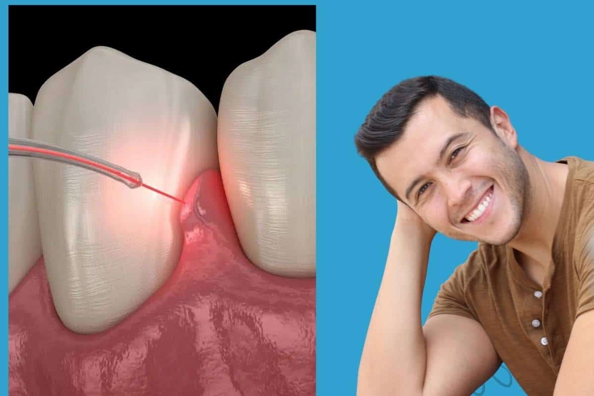 LANAP laser gum surgery procedure treating advanced gum disease