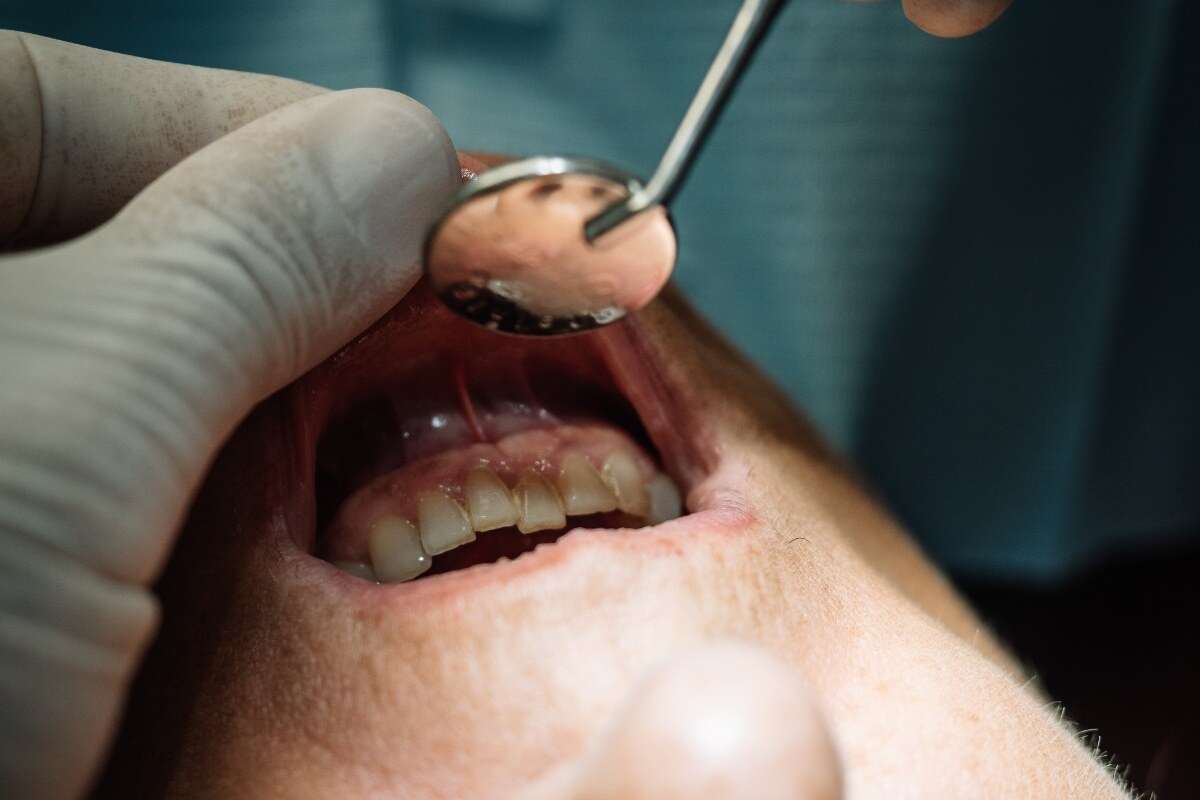 Oral Care Habits to Protect Against Gum Disease