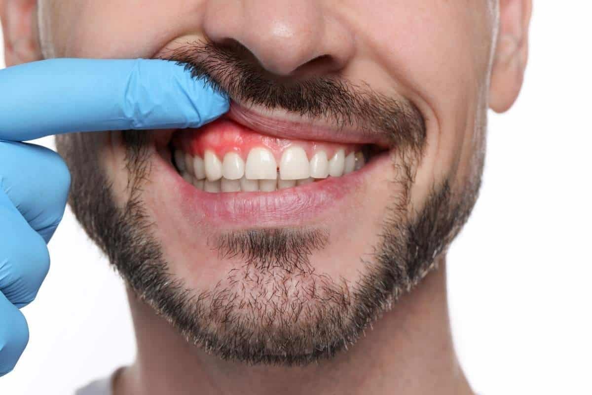 Laser vs. Pinhole: Modern Gum Recession and Gum Disease Treatments Compared