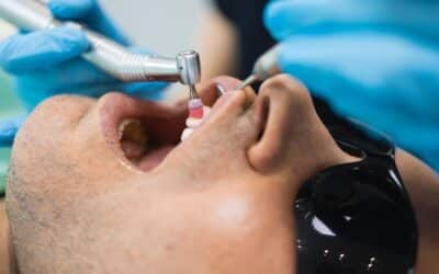 Why Phoenix Patients Are Switching To Laser Gum Therapy