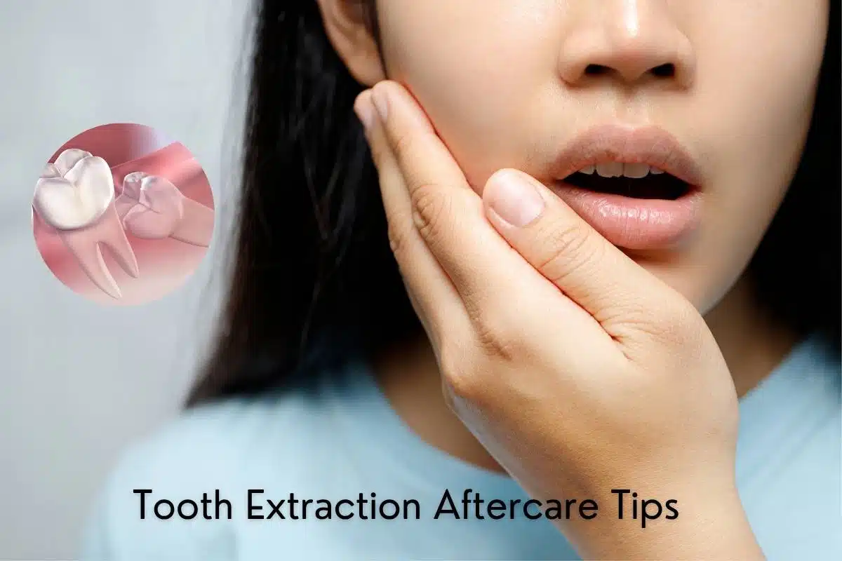 Tooth Extraction Aftercare