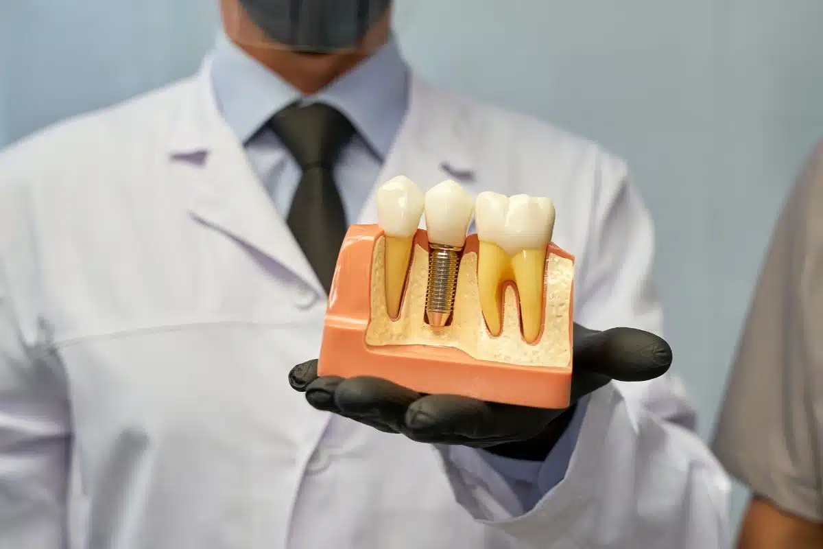 Sinus Lift vs Bone Graft