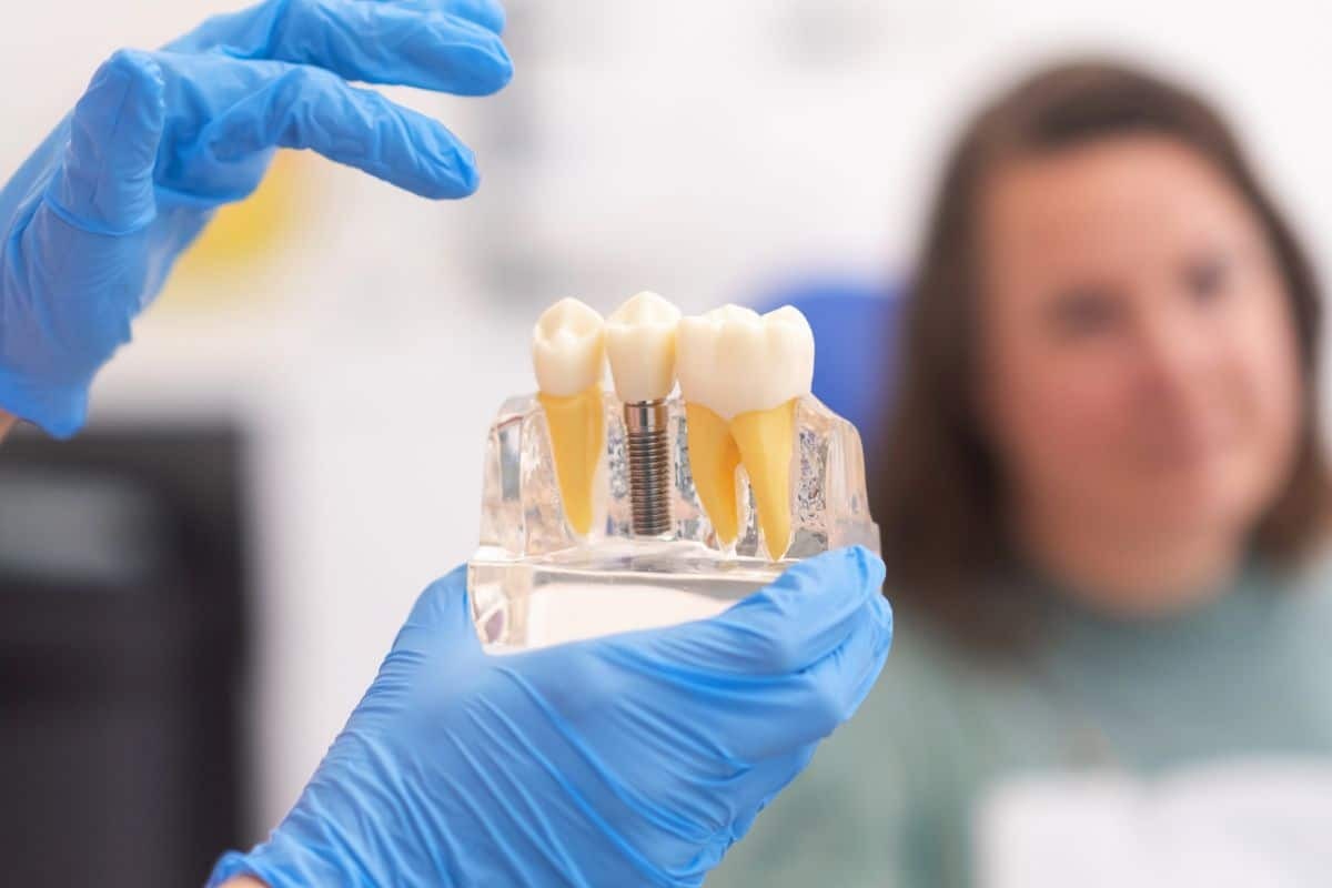 Dental Implant Candidacy